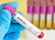 Bantah Tudingan Gubernur Sulteng soal Penyakit Antraks, Pemerintah Provinsi Gorontalo Imbau Masyarakat Waspada Hoaks