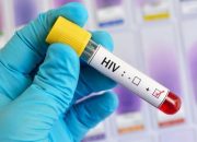 Dinkes Catat HIV-AIDS di Kota Palu Tembus 1.815 Kasus, Cegah Penyebaran Lewat Program STOP
