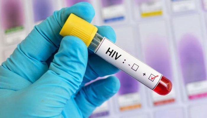Dinkes Catat HIV-AIDS di Kota Palu Tembus 1.815 Kasus, Cegah Penyebaran Lewat Program STOP
